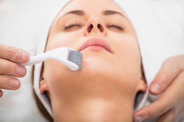 Microneedling / Dermaroller - Dermatologist in Kothrud, Pune